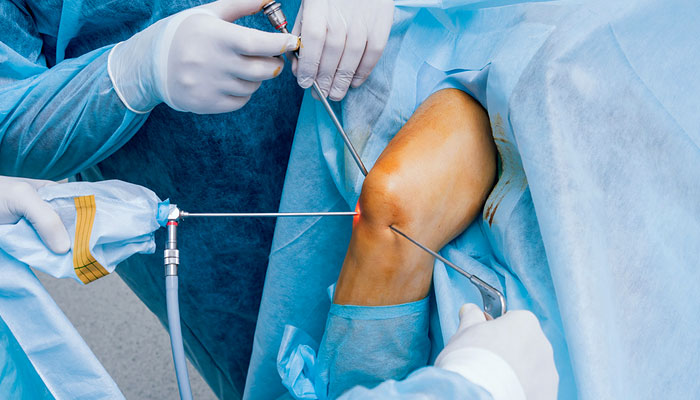 Leading Surgeon For Arthroscopic Surgery In Jogeshwari